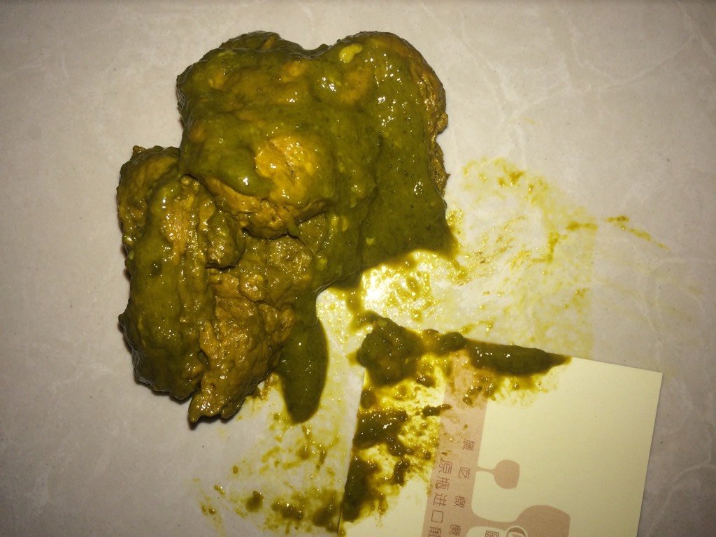 宝宝六个月便便有绿色黄色参杂,平时是五天左右排一