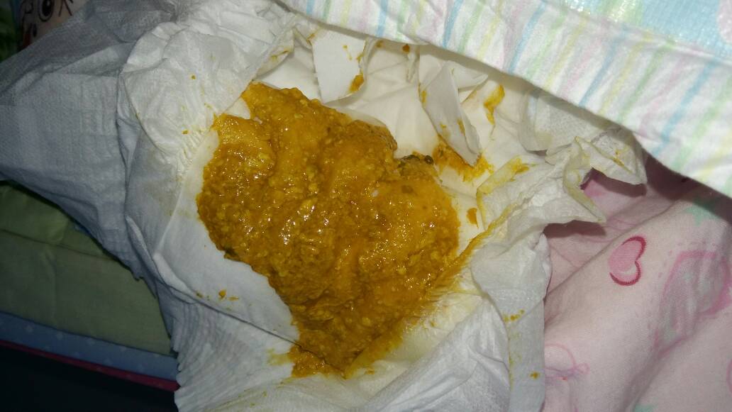 宝宝前几天总是拉屎费劲 一点一点每天有三四次