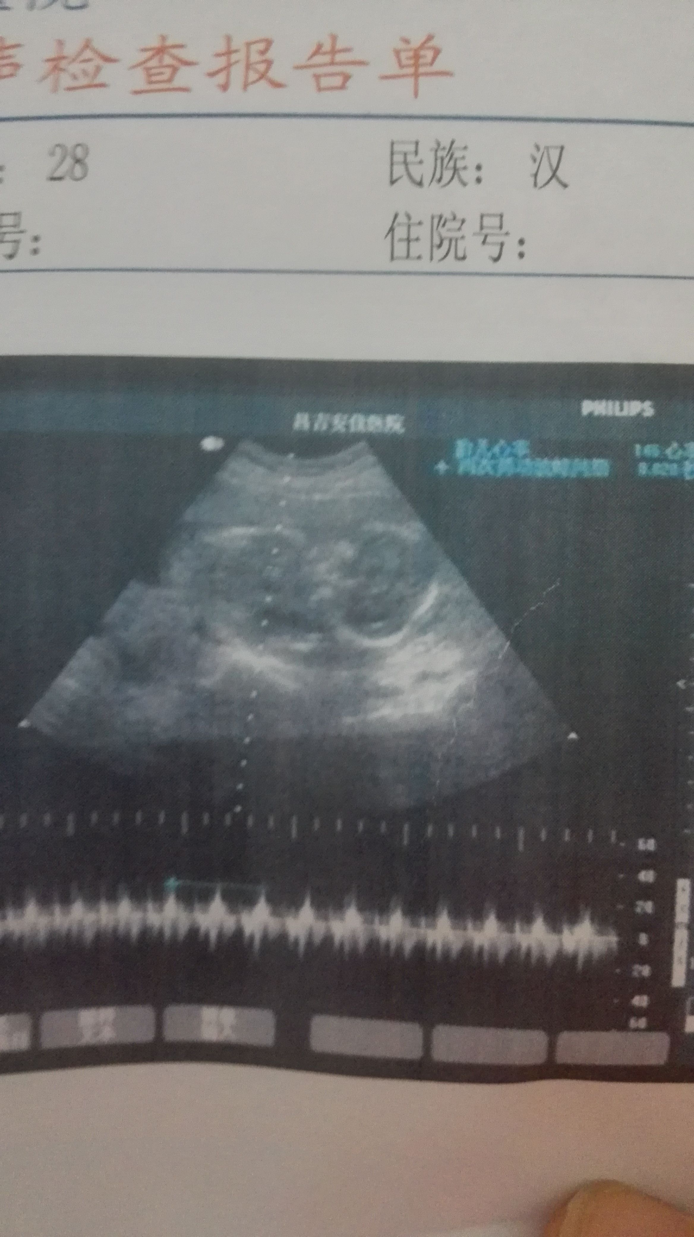 请问怀孕初期b超单图片制作-怀孕单子抽血检查报告图片制作 - 知乎