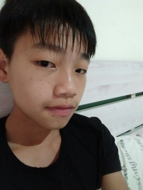 我今年15岁这种脸是婴儿肥吗?