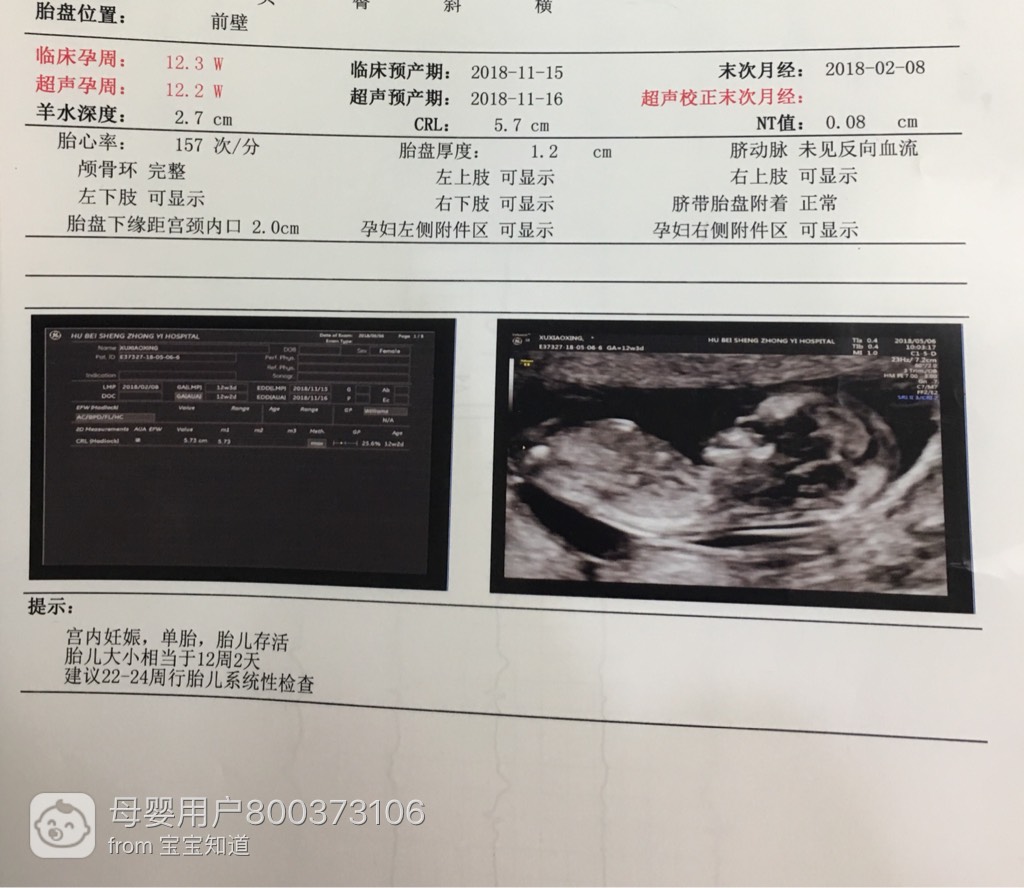 怀孕12周彩超图片图片