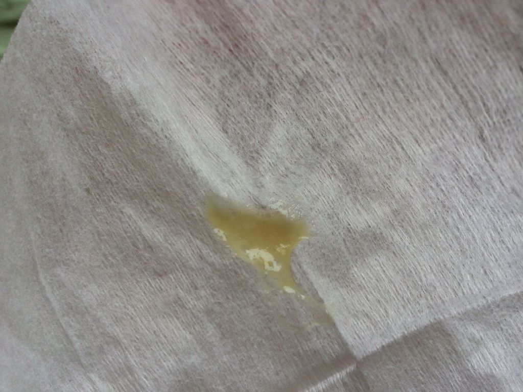 每天都有这样的黄色痰，请问这样上火的三周岁小孩可以长期喝什么中药好？