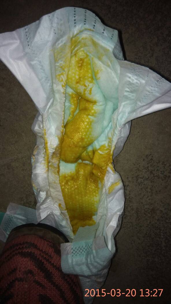 宝宝拉的大便有一点稀,是不是肚子坏了