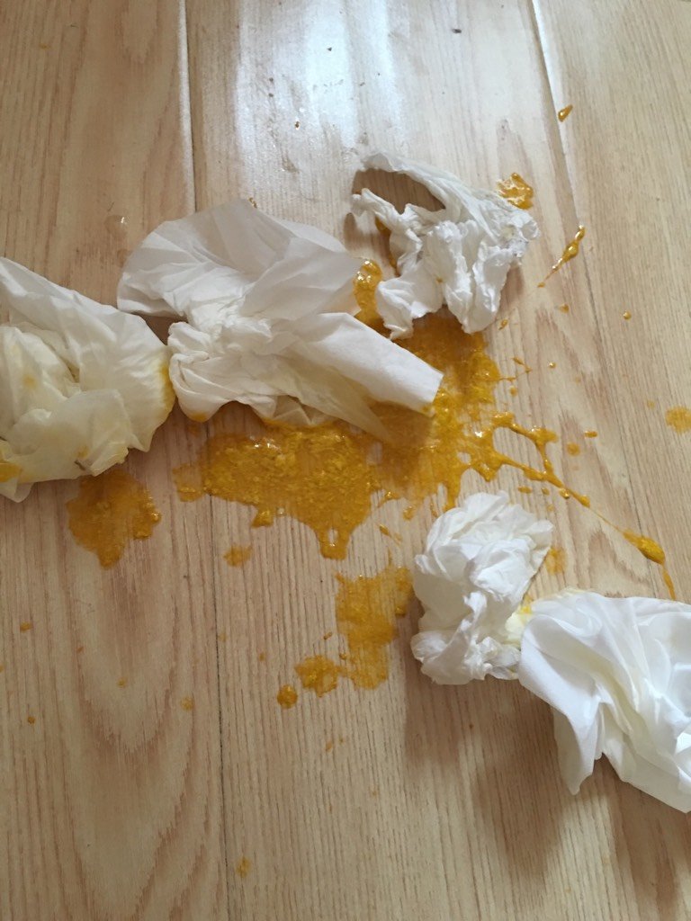 每次都是很少的量,大便的次数又多,一天10多次这样,大部分母乳喂养的