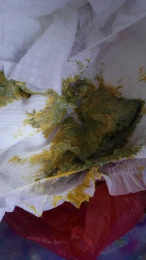 问答 1月-1岁宝宝马上就三个月了,这几天怎么拉这种颜色的便便是怎么