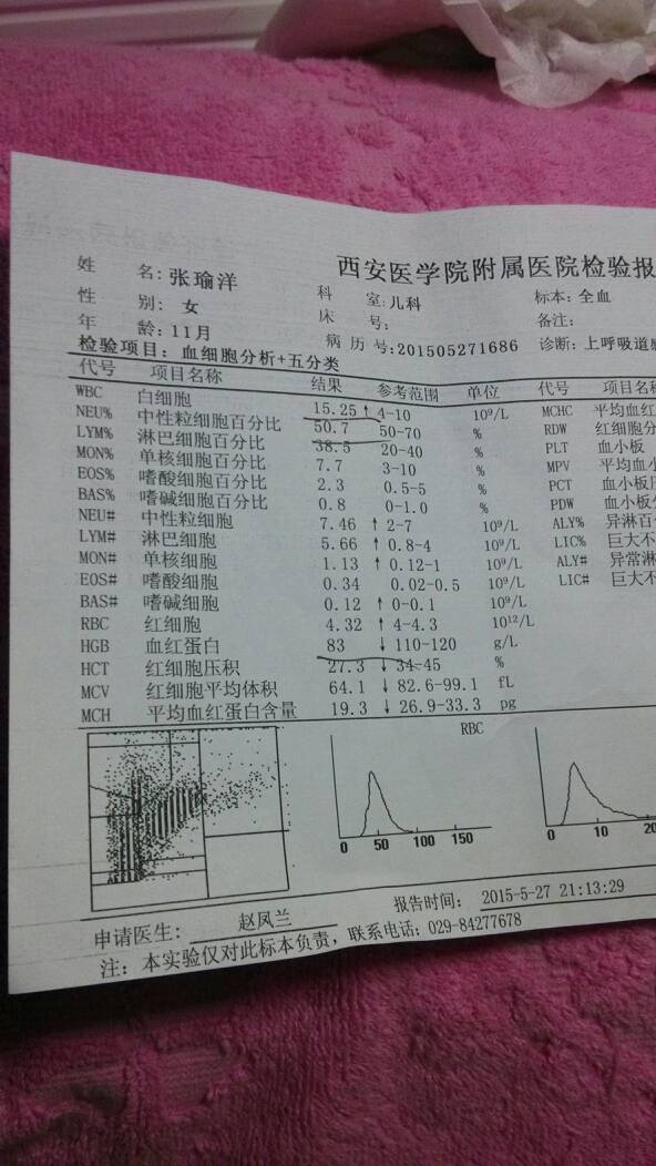 宝宝发烧无其他症状,38