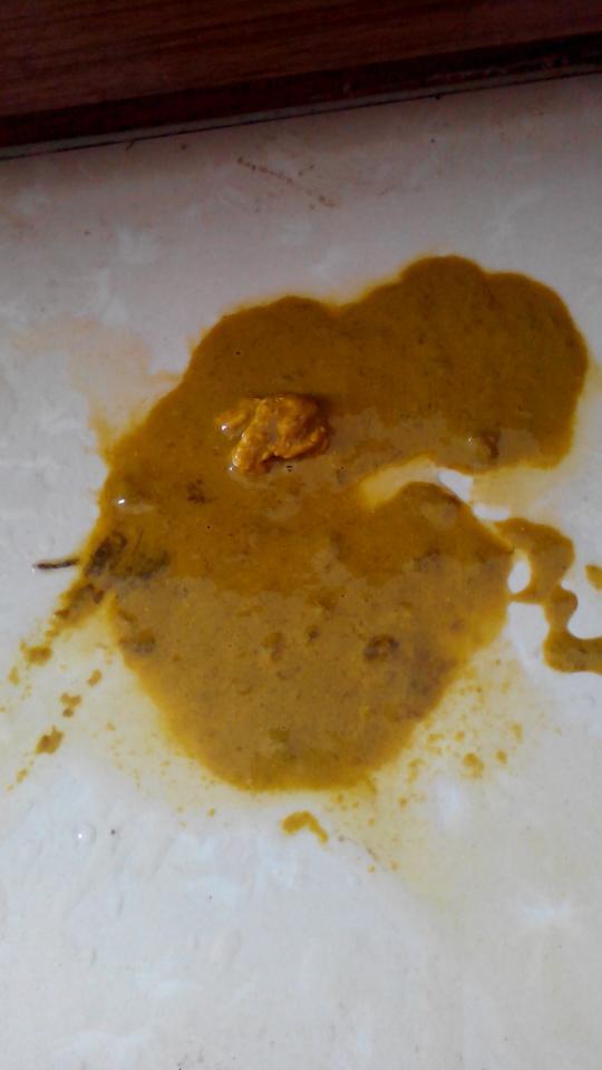 六个月感冒了,去医院开了感冒药,现在啦这样的大便是怎么了