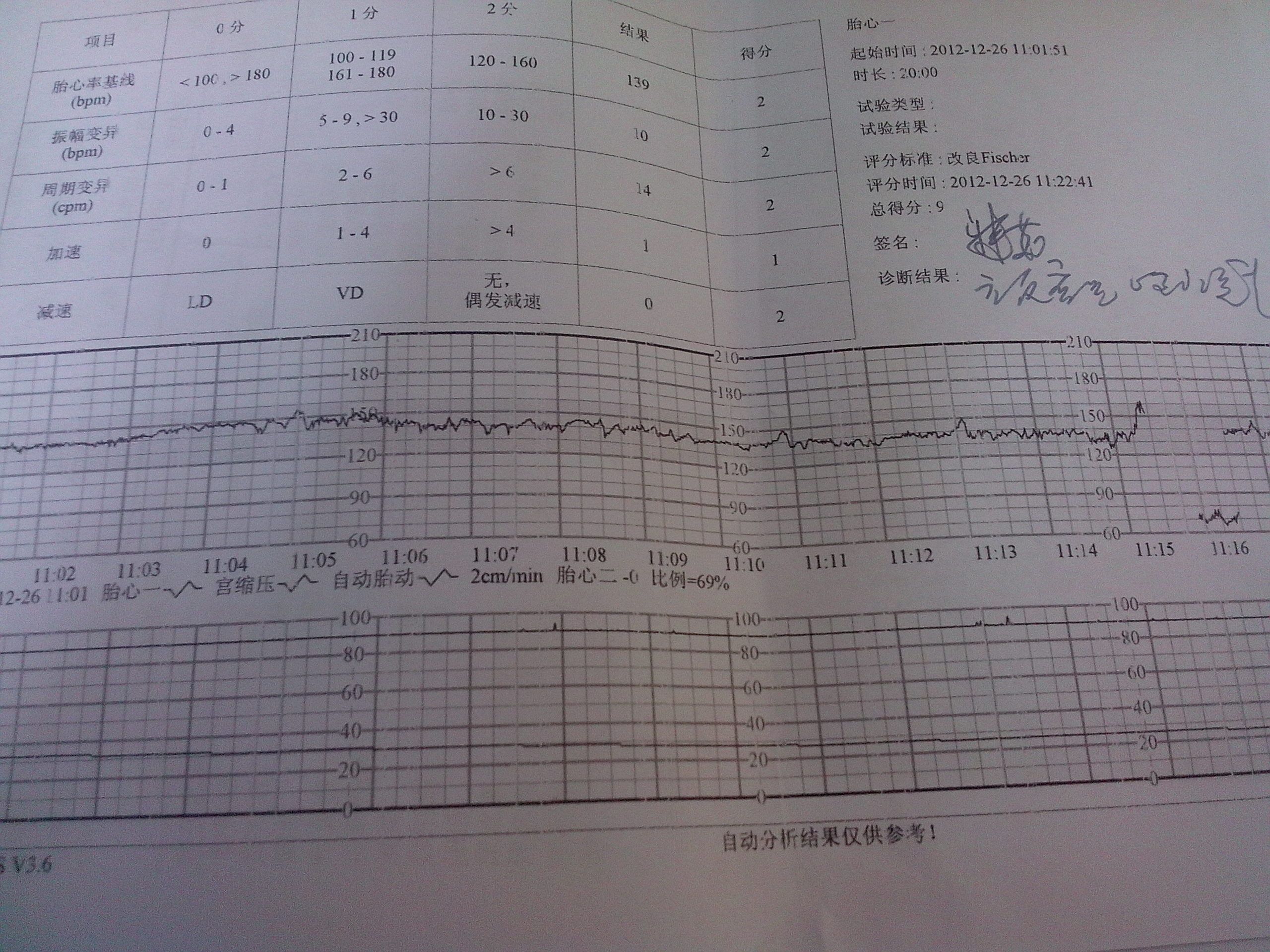 请帮忙看下这份胎儿心电图,急死了!