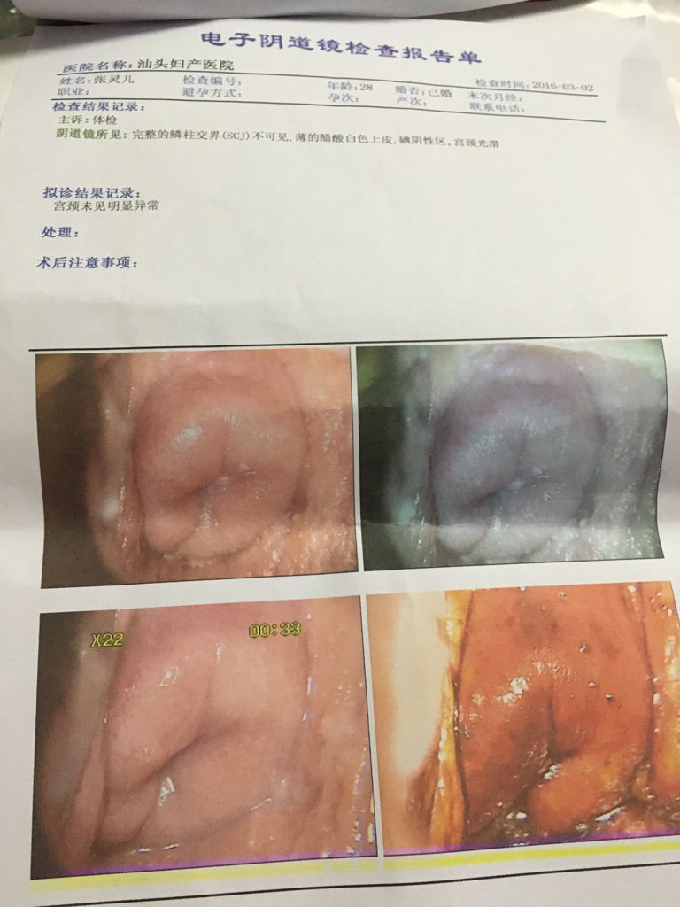 我离月经还差一个星期,正在排卵,有多个卵泡,但是内膜只有5毫米!