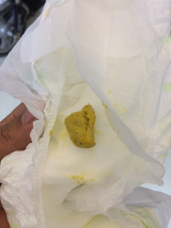 30天的宝宝奶粉喂养,拉大便困难,呈颗粒状,特别大一块怎么回事,要