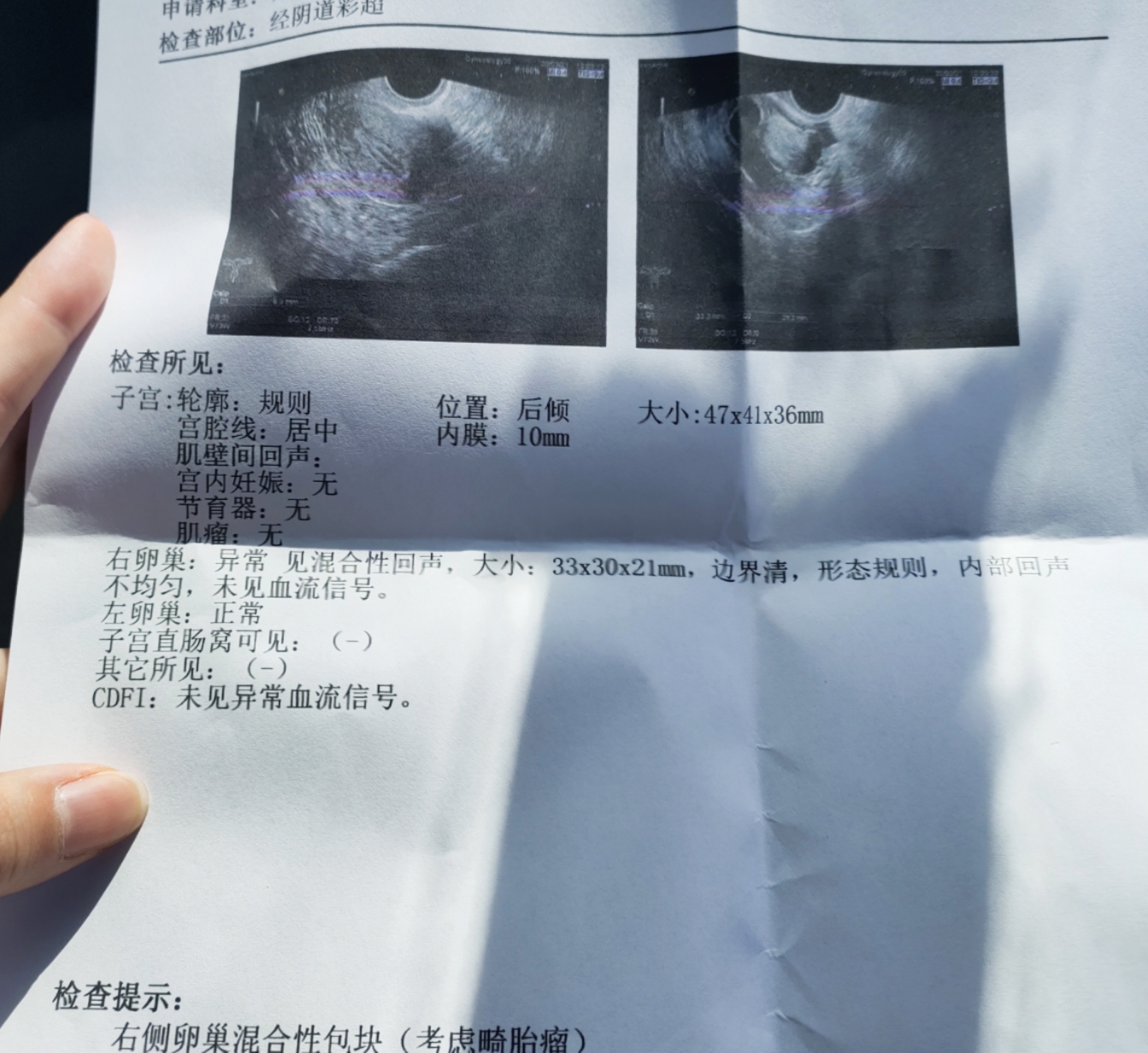 畸胎瘤3.3cm×3cm可以先怀孕吗