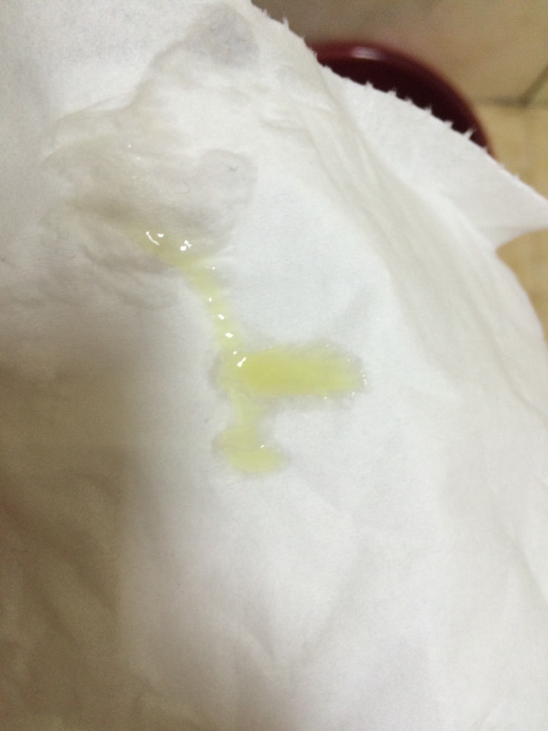 泡沫状白带黄绿色图片