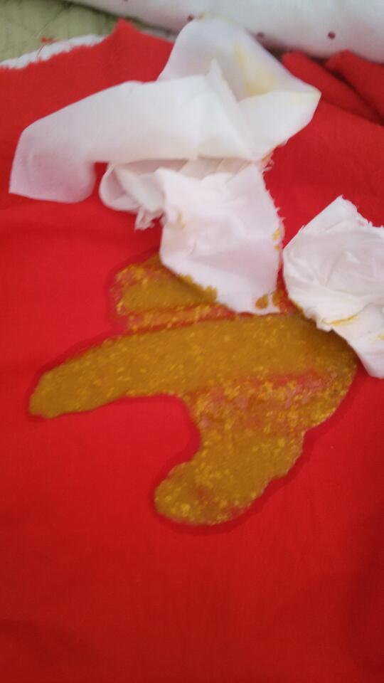 昨晚开始停掉奶粉,只母乳,但是还是放屁崩稀粑粑,有图