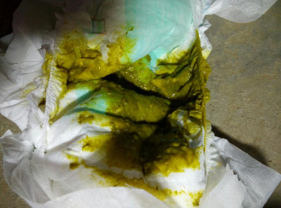 七个多月的宝宝拉这种粑粑都快两个星期了,打针吃药还是没什么变化