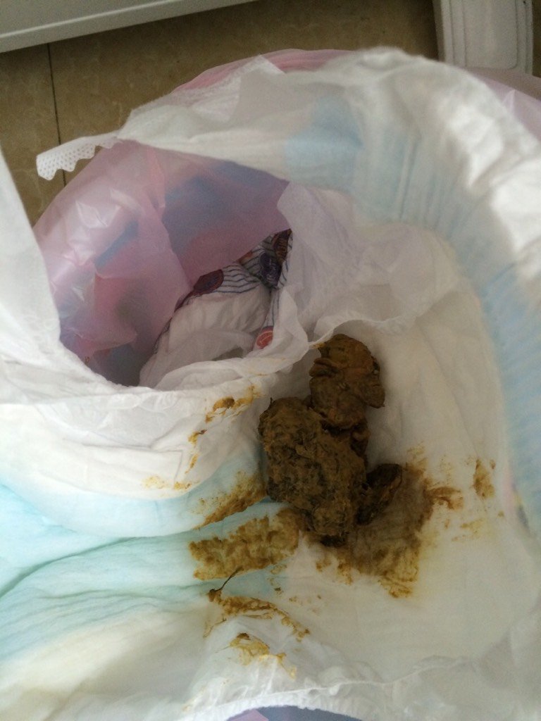 六个月婴儿每天一次大便有点干正常吗?