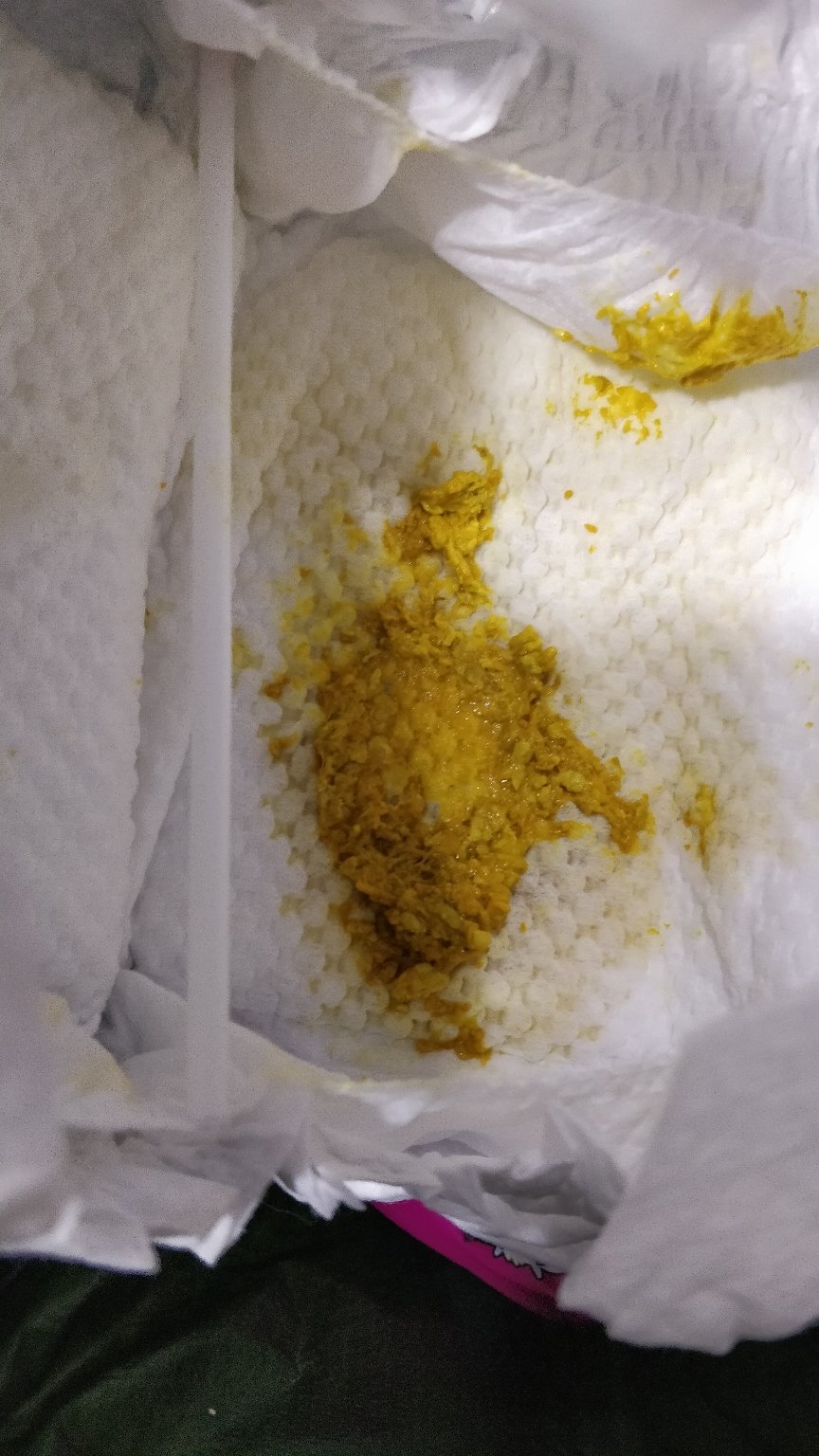 宝宝11天了,这两天一打屁就流点粑粑出来是怎么回事?正常吗?