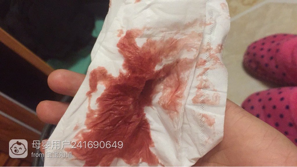 怀孕三个多月,昨天流了淡粉色的血,去医院检查医生说先兆流产,今天又