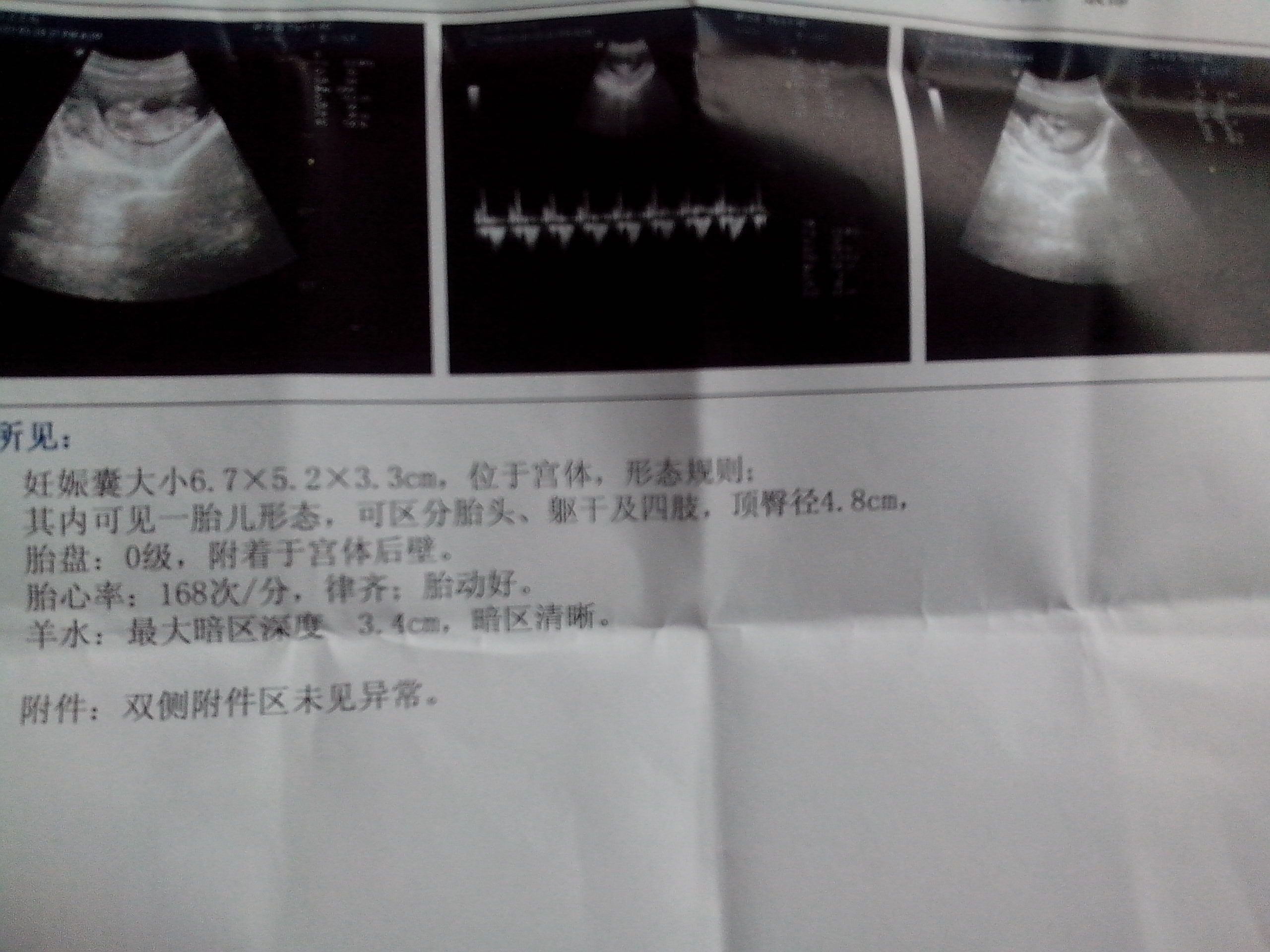 怀孕5周孕囊大小图片-图库-五毛网