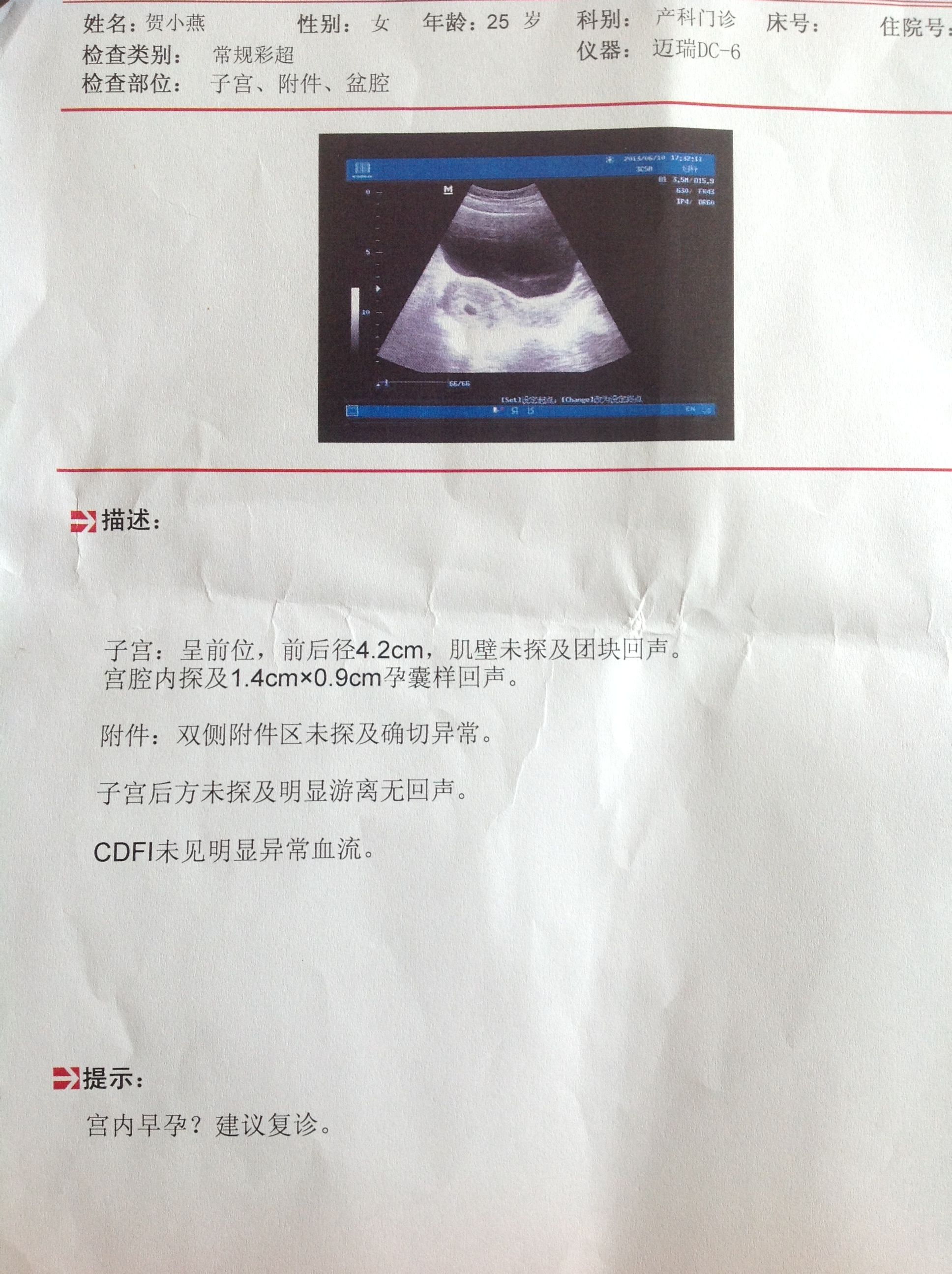 医生您好，B超显示我早孕11周（9.9日检查），B超显示胎盘_产科_邻医网