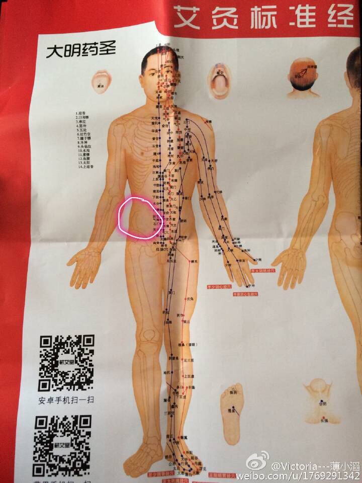 女18岁右下腹痛/右前腰(图中被圈位置) 特别痛!