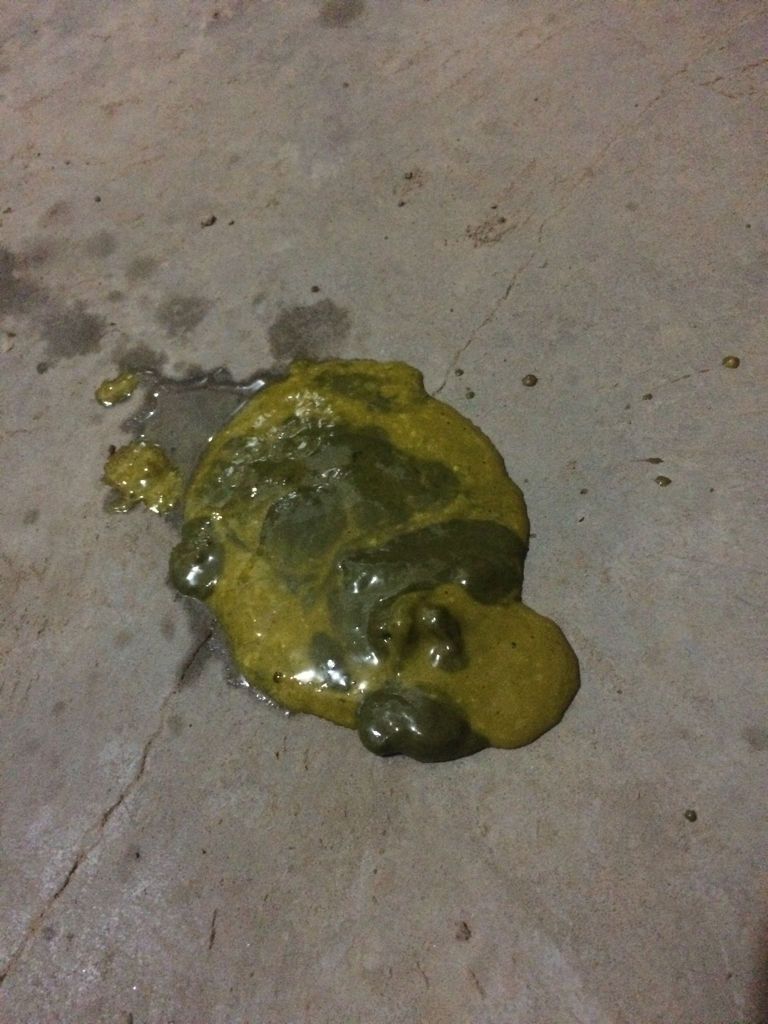 我家宝宝三个多月了,奶粉跟母乳一起喝的,拉的屎特别绿,头开始还以为