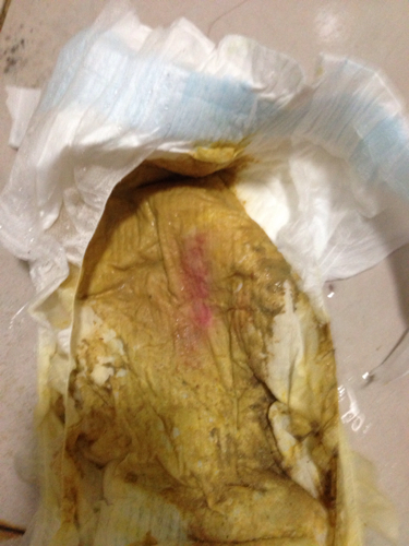 一岁多一点的宝宝拉肚子带血是怎么回事?