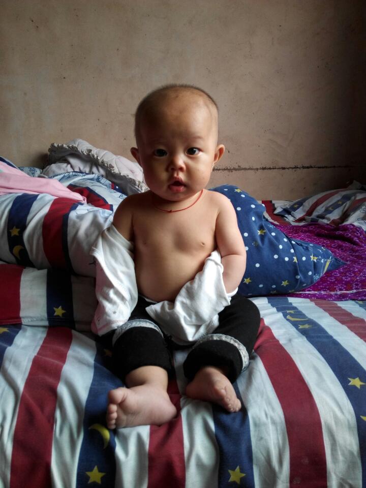 我宝宝胸这样正常吗?看到很多性早发育,吓死人了