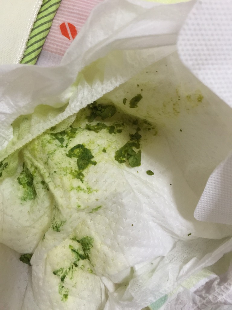 宝宝吃了蒙脱石散，拉屎绿色的还一团一团怎么回事？？？医生给开的