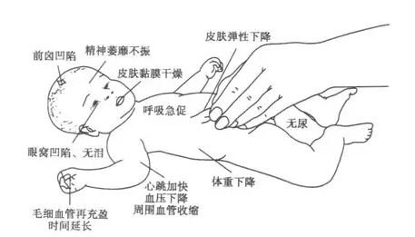 注意 孩子拉肚子痊愈后的正确做法