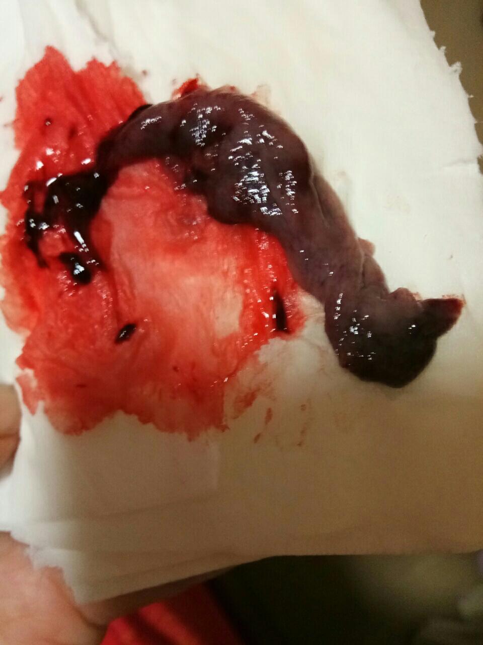 10楼 我刚上洗手间又掉下来一块