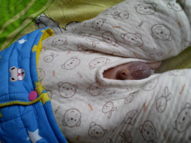 宝宝这个这么小要紧不