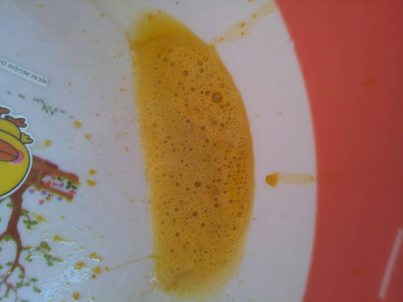 急急急 宝宝拉了两天大便 都是泡沫 有经验的妈妈说要去医院看看吗？