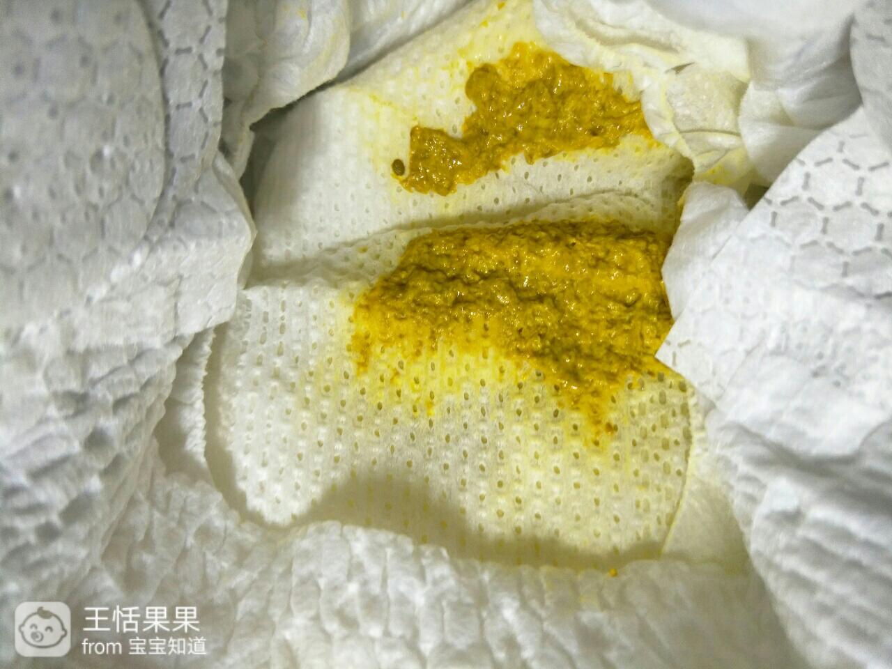 宝宝六天一天大便五六次金黄色带有酸酸臭臭的味道有宝妈知道正常么？