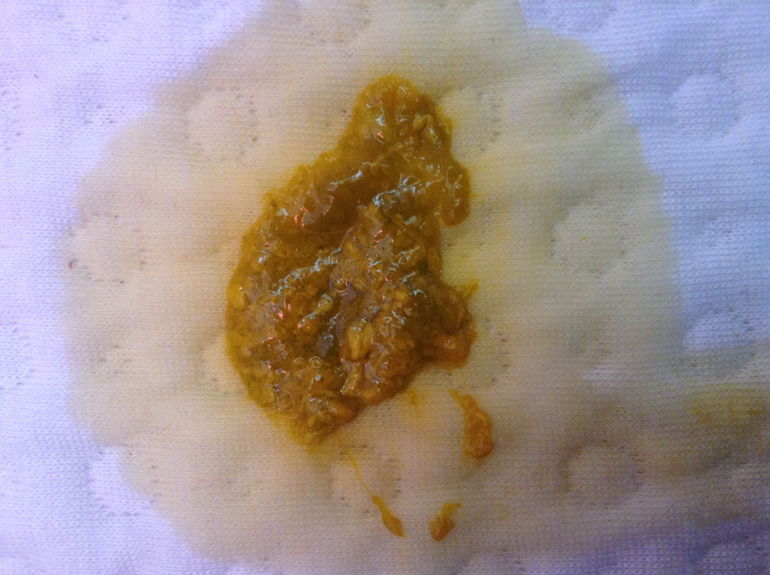 问答 问答首页为您推荐: 其他回答 病情分析: 你好,从你孩子的大便