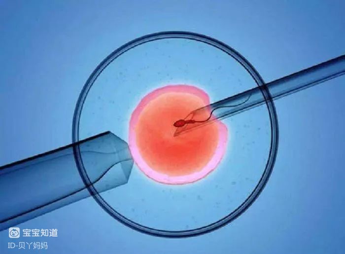 高龄女性做供卵借卵试管代生,提高成功率的5个秘诀