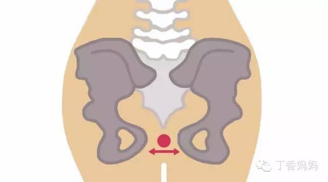 孕妇大腿根部痛?小心耻骨联合分离!