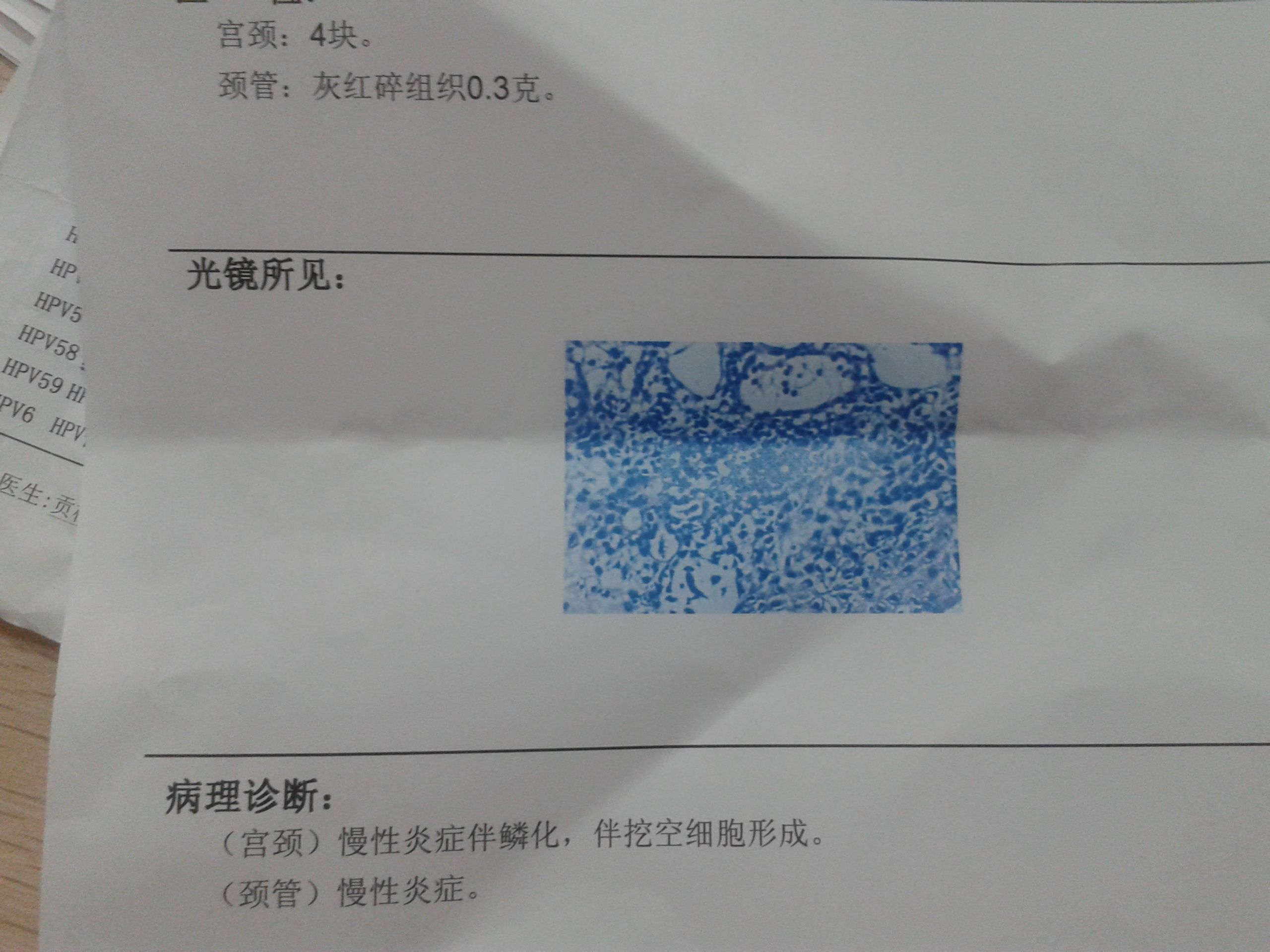 卵巢癌诊疗指南（2022年版）