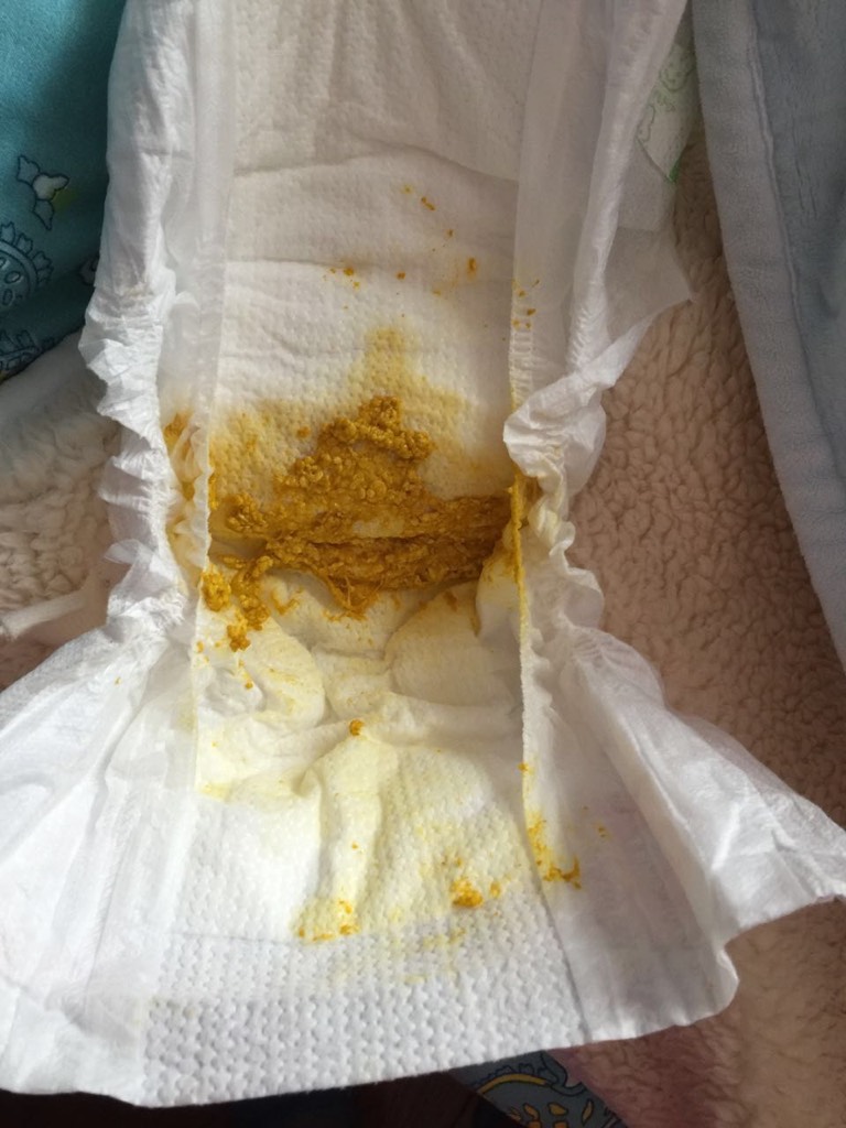 拉奶瓣是什么样子的啊?那个宝妈有图
