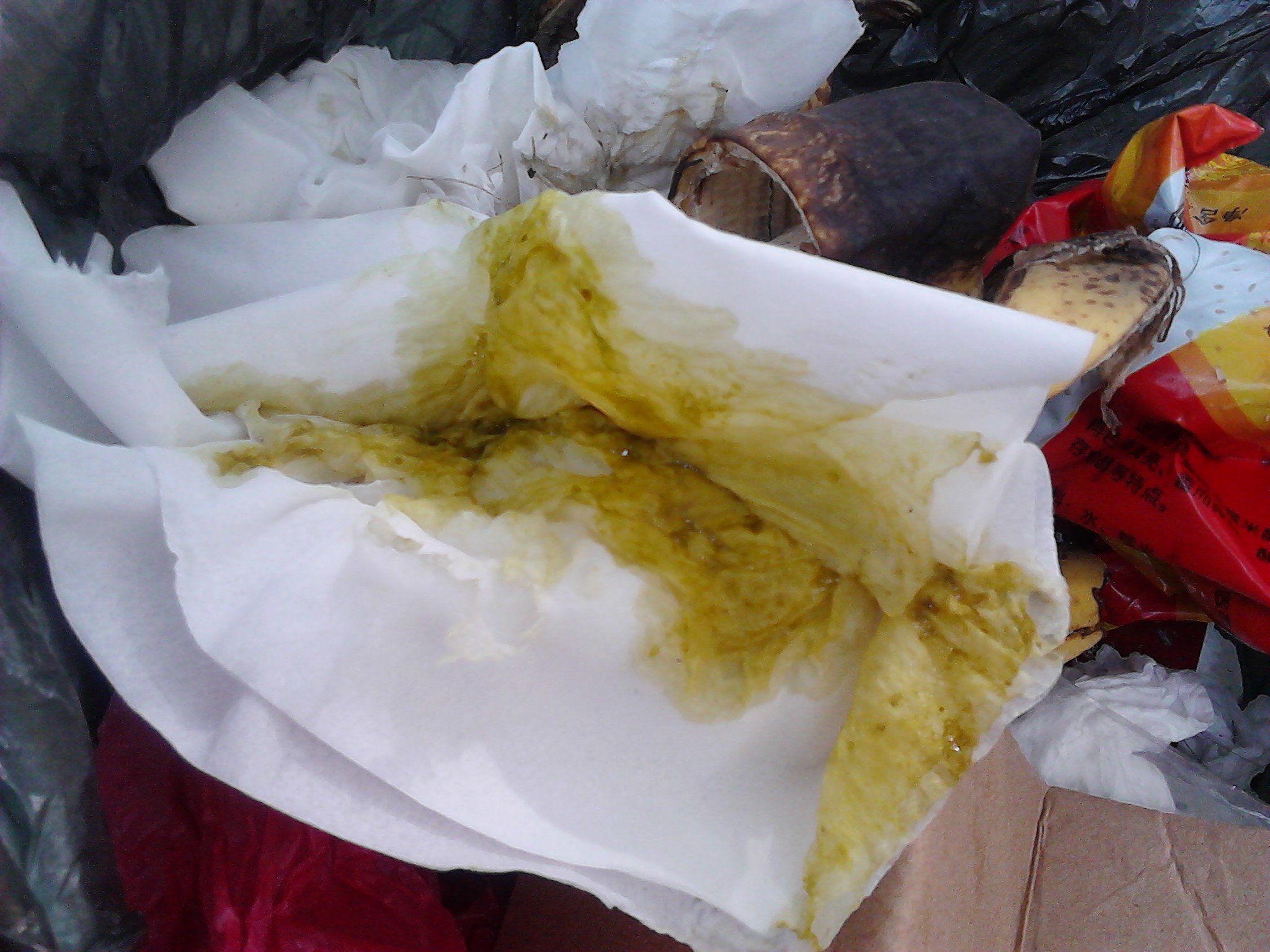 小孩拉肚子该怎么办,有照片,是咋回事啊?