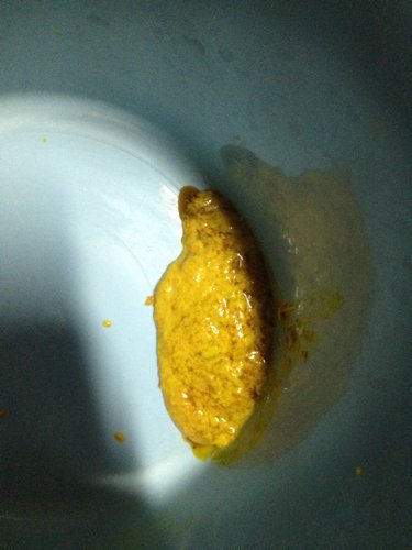 宝宝最近几天拉这种便便,一天1.2次,请问什么情况