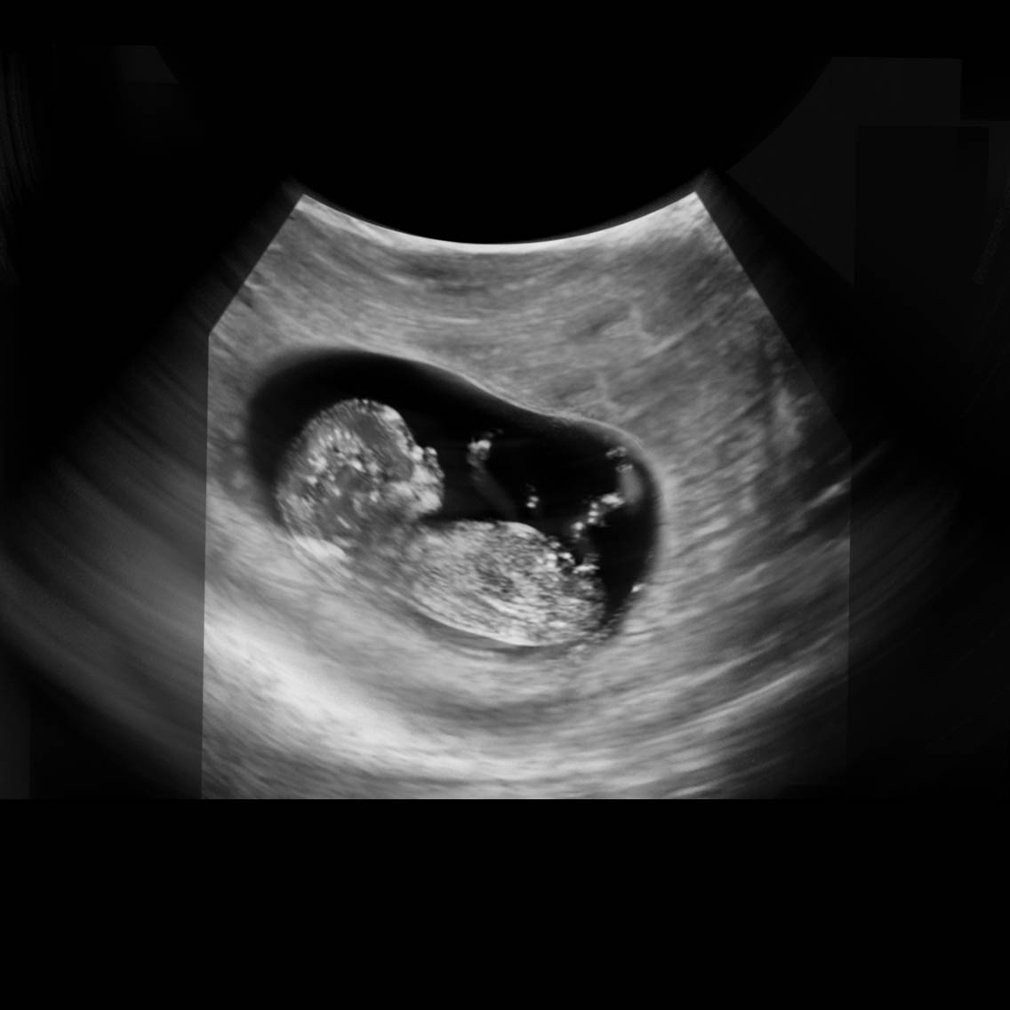 胎儿40天的样子图片图片