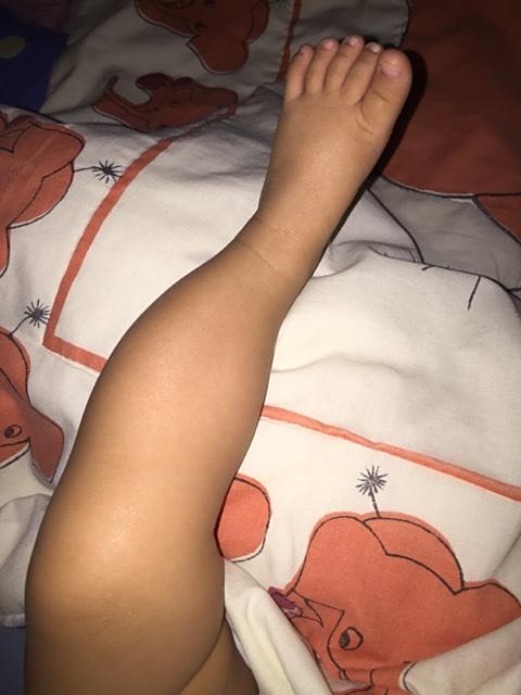 我家宝宝现在四个月,我感觉宝宝的小腿弯,可是老人都说小孩都这样,我