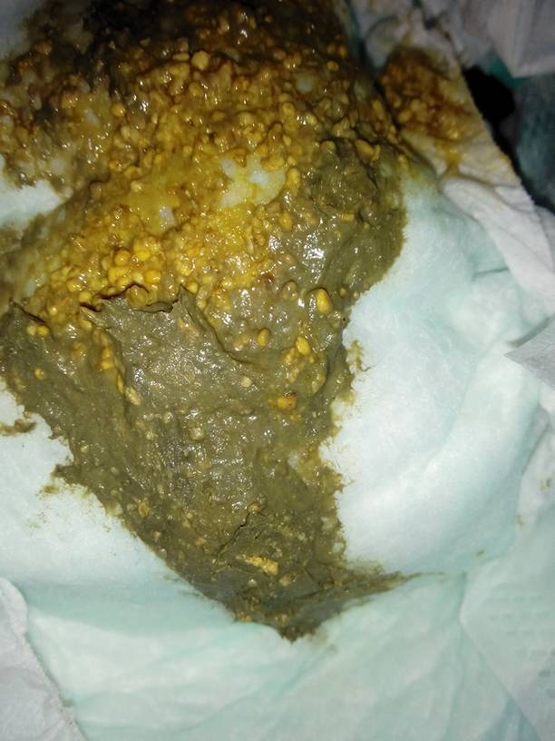 宝宝两个月吃奶粉,从昨开始拉粑粑有点稀,颜色像深绿色还好臭怎么办?