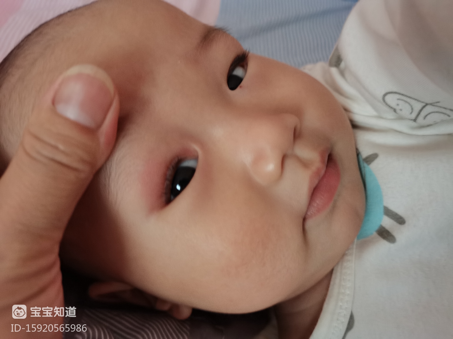 六个月宝宝眼皮部位红肿,怎么回事?