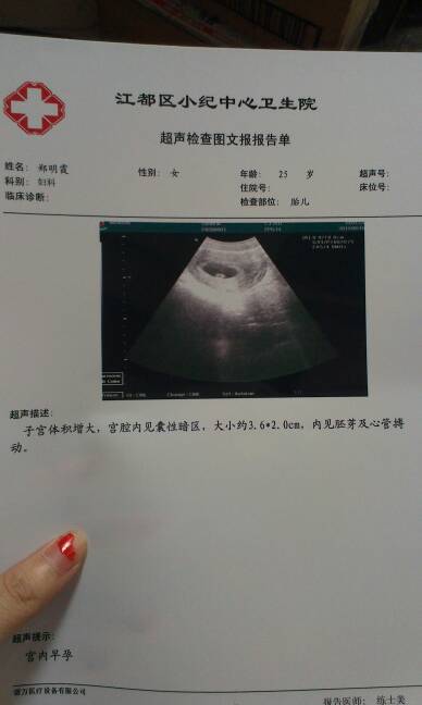 怀孕60天,这个结果怎样