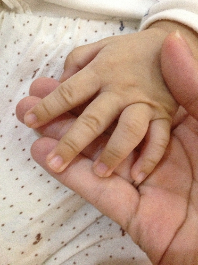 你们好,我想问一下我家宝宝现在两个多月,宝宝的手指前端有些少发黑