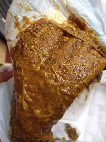 宝宝58天了,之前大便是金黄色像南瓜泥样,最近大便都是这样的里面总有