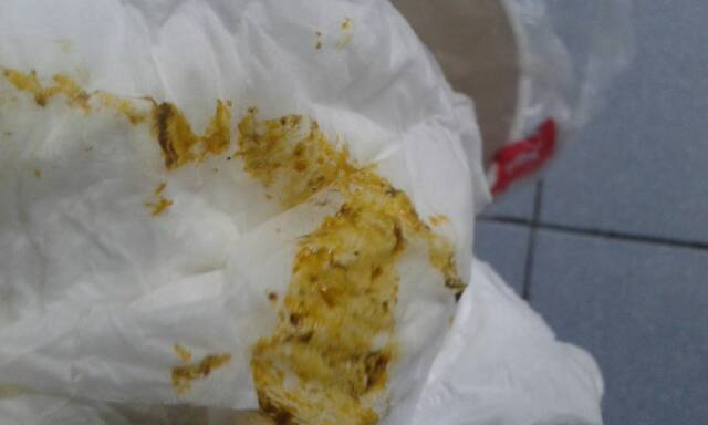 的,黑色是粘稠样的请问是正常的吗?是不是宝