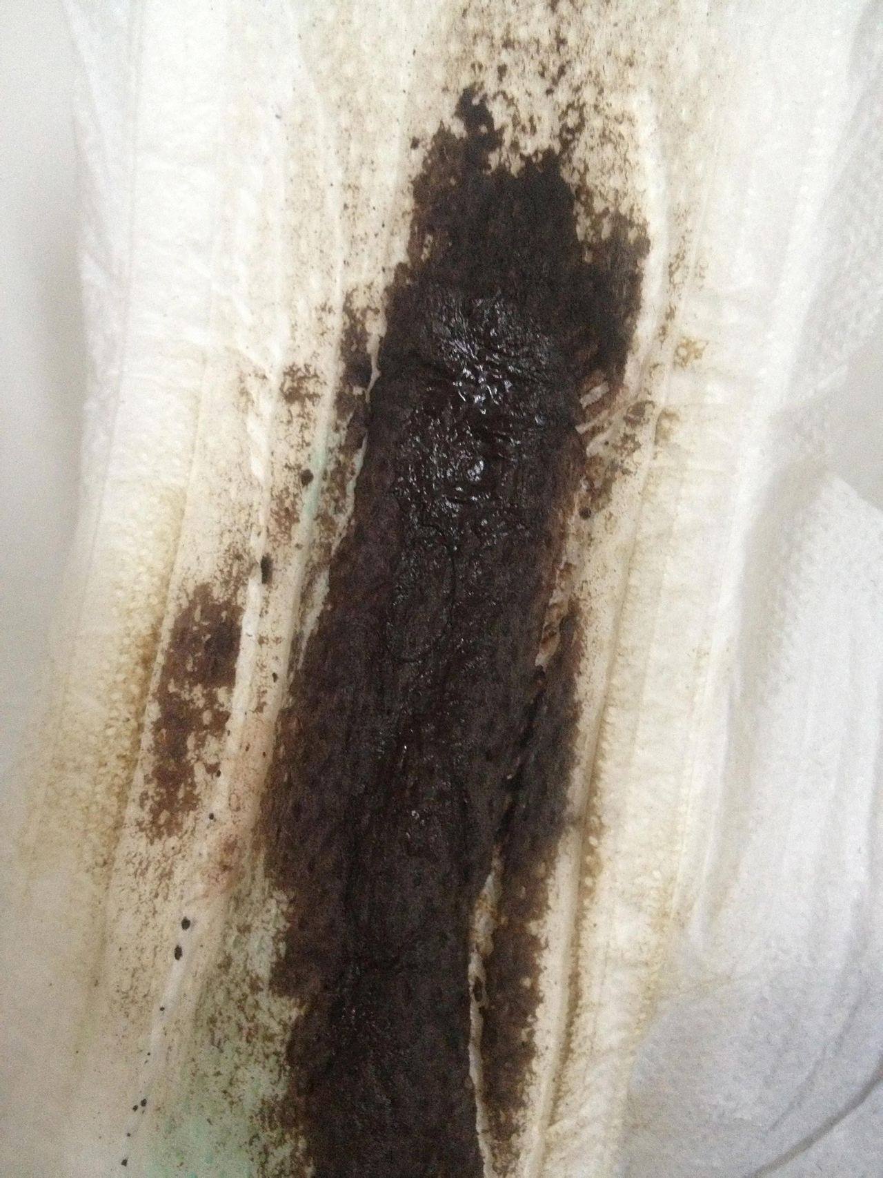 月经不调 常年如此