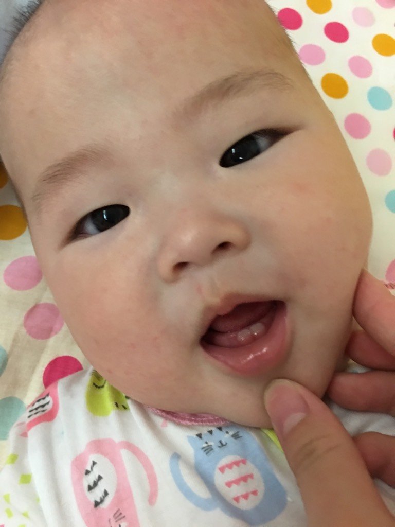 我宝冒了两颗小牙